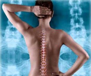 ზურგის ხერხემლის ილუსტრაცია